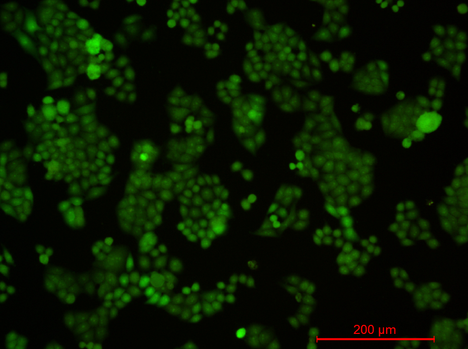 Hela-GFP.jpg