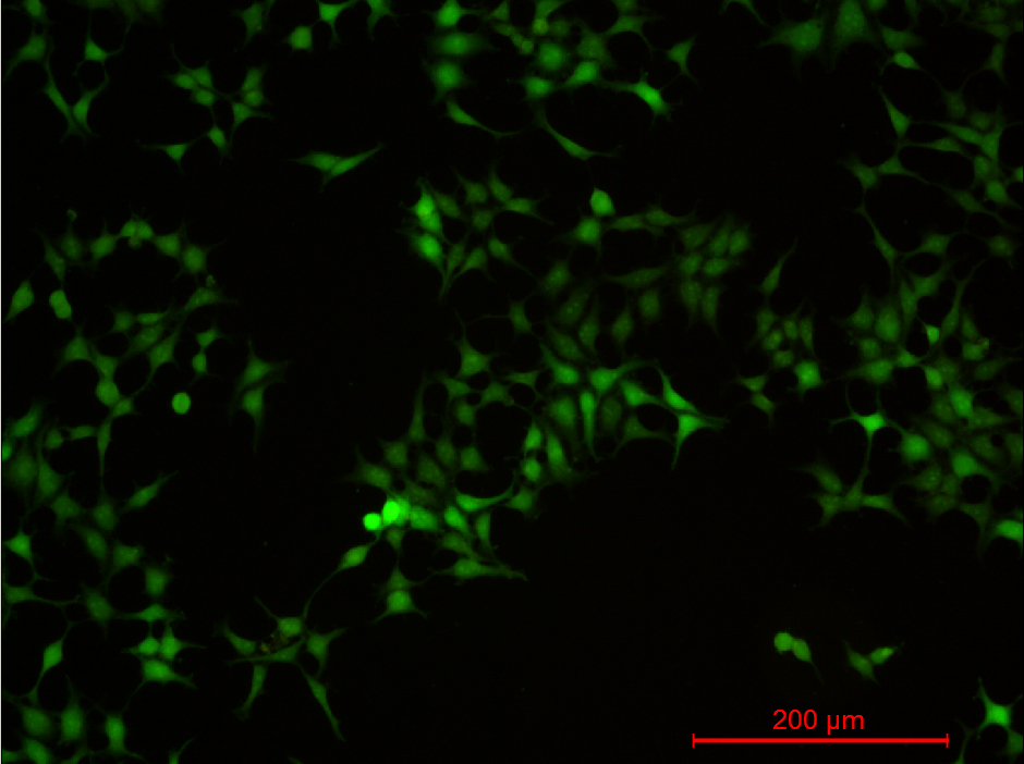 293T-gfp.jpg